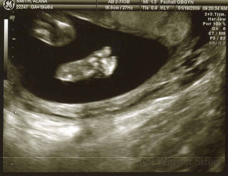 3rd Ultrasound 01.jpg